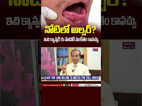 When Are Mouth Ulcers Serious? | Dr P Vijay Anand Reddy