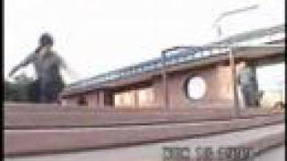 buck 65:  sleep Apnoea