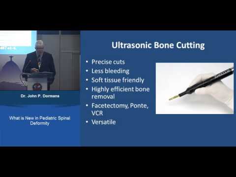 WHAT IS NEW IN PAEDIATRIC SPINAL DEFORMITY