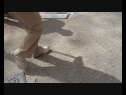 Ankle Dystonia improvement