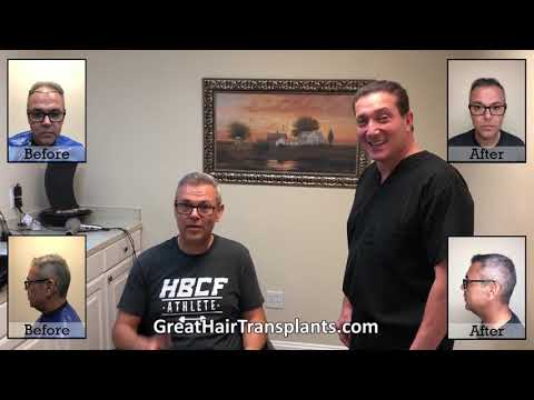 Dr. Brett Bolton Patient Eduardo MaxHarvest&trade; Procedure

