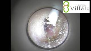 耳掃除動画vol.27「眠くなりました…」