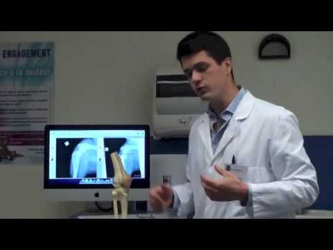 comment guerir un ligament dechire