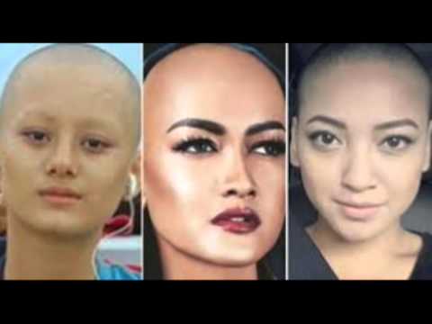 rambut jupe botak news