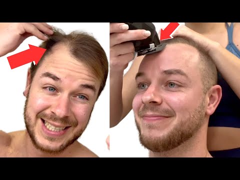 SHAVING My RECEDING HAIRLINE To A Grade 1 BUZZ CUT *Transformation*