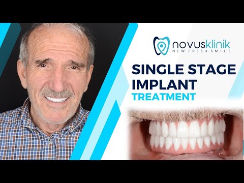 One-Step Implant Treatment: Patient Evaluation at Novusklinik, Turkey