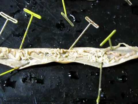 Pinworms fertőzés jelei
