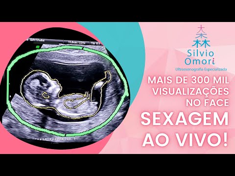 Ultrassom obstétrica. Gravidez 12  Doze semanas e seis dias!