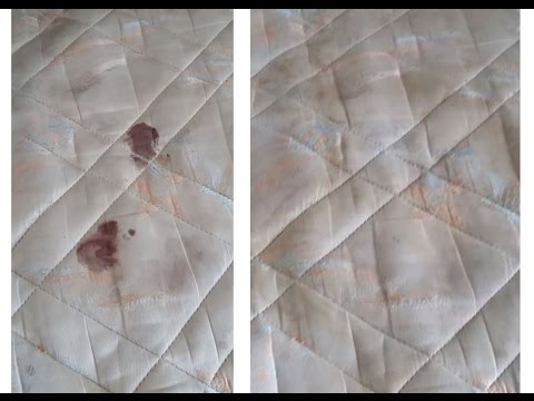 download lagu mp3 mp4 Comment Enlever Une Tache De Sang Sur Un Matelas, download mp3 Comment Enlever Une Tache De Sang Sur Un Matelas free download mp3, download mp3 Comment Enlever Une Tache De Sang Sur Un Matelas