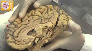 preview picture of video 'Anatomía [Lab] - Cerebro (Morfología Externa)'