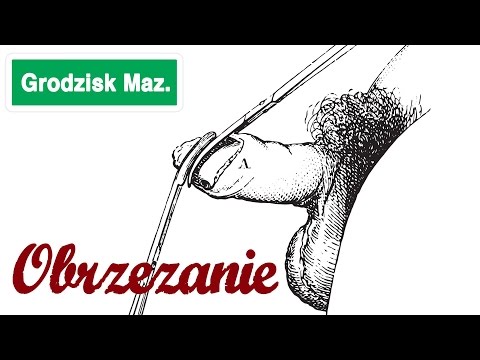 Wzrost Rady Federacji Małe pryszcze na członie lufy