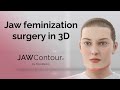 JAWContour 3D Precision In Jaw And Chin Feminization Surgery