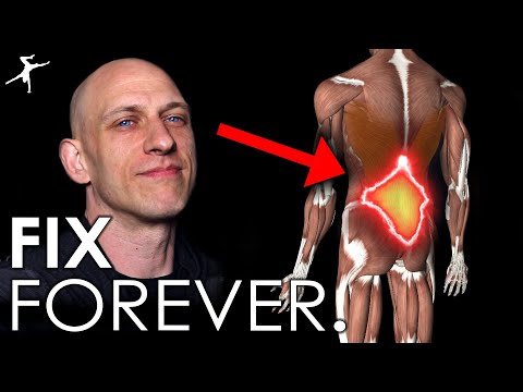 How to Fix Low Back Pain (FOREVER).