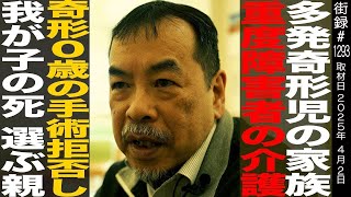 OP - 小児外科医 松永正訓/多発奇形児の家族/重度障害者の介護/奇形0歳の手術拒否し我が子の死選ぶ親