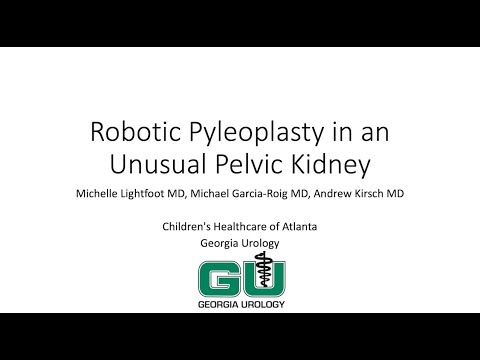 Robot Assisted Laparoscopic Pyeloplasty in an Unusual Kidney