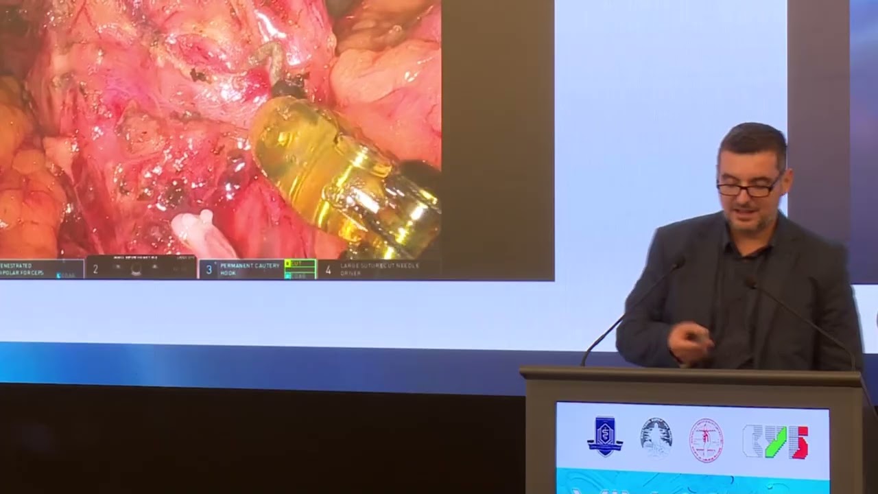 Robot-assisted resection of the middle part of the extrahepatic bile ducts in malignant neoplasms