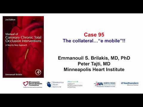 Case 95: Manual of CTO Interventions: The collateral..."e mobile"!