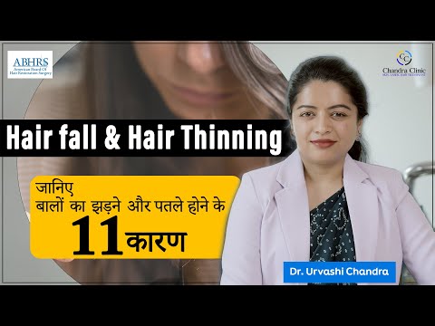 Dr. Urvashi Chandra is a hair transplant surgeon in Delhi who has been performing hair transplant surgery for over 20 years. She is the founder and medical director of the Chandra Clinic, which is one of the leading hair transplant clinics in India. https://www.chandrahairclinic.com/hair-transplant-surgeon
