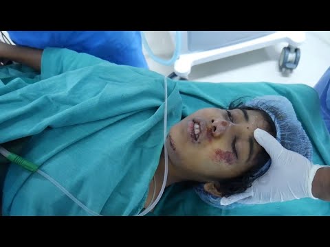 Girl Waking Up From General Anesthesia