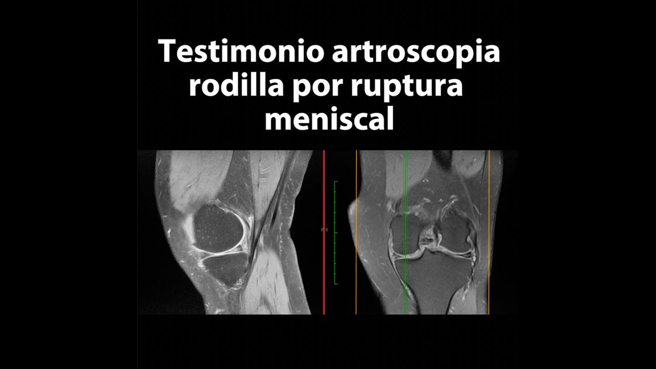 Marco Polo Malacón Gutiérrez-32