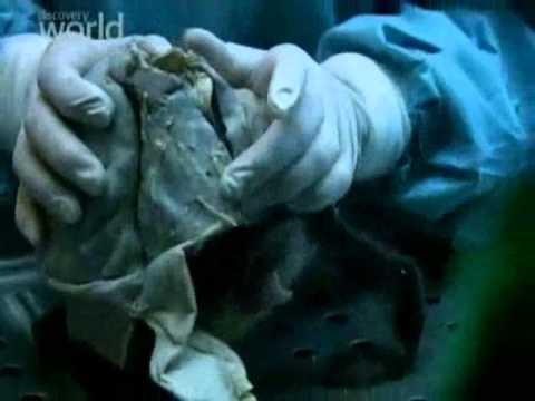 Jak powiększyć penisa w ciągu 3 dni Dziecko urodziło się z małym penisem