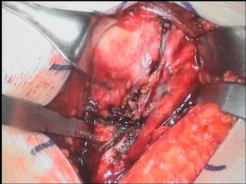 Giunti rigidi in diverse parti del corpo Ossa doloranti articolazioni scricchiolio