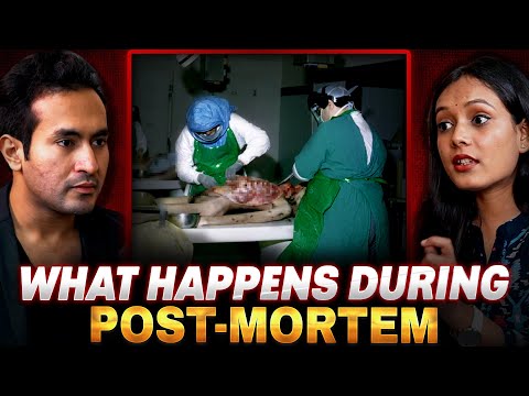 What Happens During POST-MORTEM?