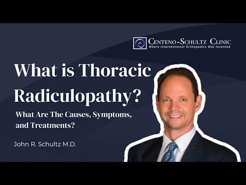 What is Thoracic Radiculopathy? What Are The Causes, Symptoms, and Treatments? (w/ Dr. John Schultz)