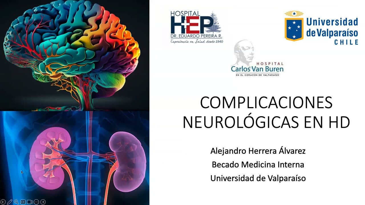 Complicaciones neurológicas en Hemodiálisis