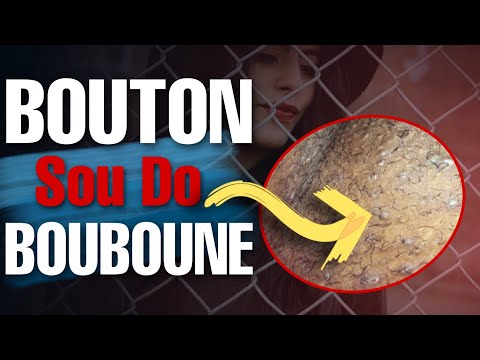 ► Sak Koz 𝐁𝐎𝐔𝐓𝐎𝐍 sou Do 𝐁𝐨𝐮𝐛𝐨𝐮𝐧𝐞 - Ki Tretman Naturel ou ka fè pou w Clean Chòbèbè.