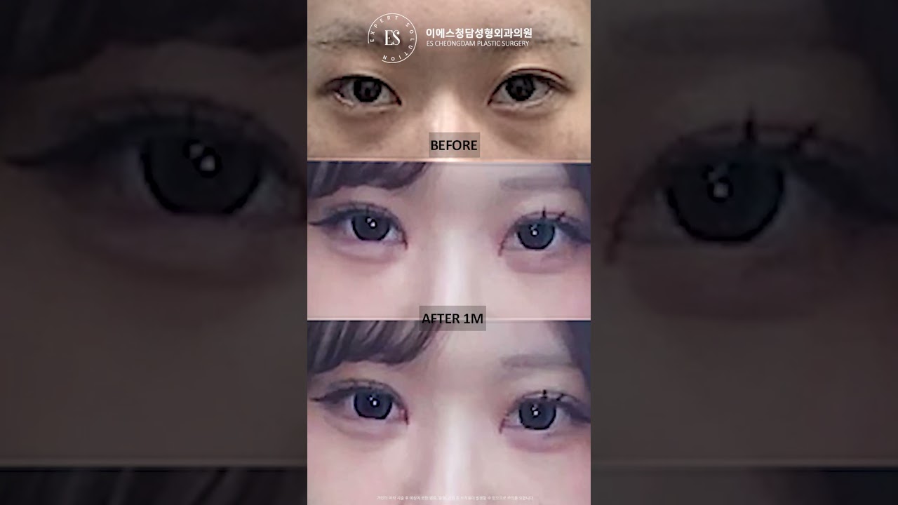 이에스 유튜브