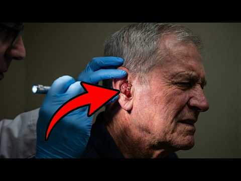 Doctors Expected a Simple Pimple—But What They Found Behind Her Ear Was Terrifying!