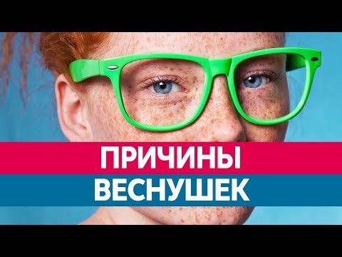 Девушки блондинки с веснушками Пигментные пятна на внутренней стороне бедер что это