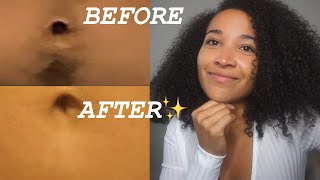 HOW I REMOVE HAIR FROM MY STOMACH | No Shaving or Waxing