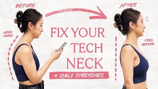 I fixed my BAD posture with 4 easy stretches *expert approved*