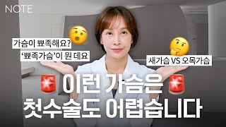 [가슴 수술 포인트] 첫수술도 어려운 가슴 l 촉진의 중요성 l 합유증 l 더블라인  l