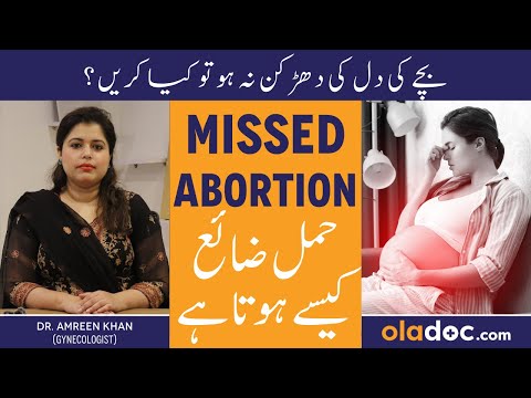 WHAT IS MISSED ABORTION - Bache Ki Heartbeat Na Aane Ka Wajah - Pregnancy Loss - Miscarriage In Urdu