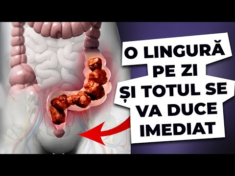 , title : 'Iată cum poți să Scapi de Constipație o dată și pentru Totdeauna!'