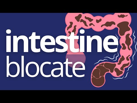 Ocluzia INTESTINALĂ: 6 SEMNE care te trimit la Medic