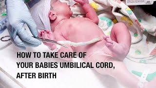 How to take care of your babies umbilical cord, after birth