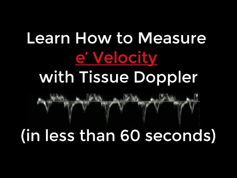 How to Measure e' Velocity with Tissue Doppler for Diastolic Dysfunction Measurement in 60 Seconds!