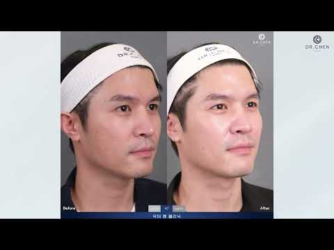 Exosome Baby Skin Booste  ช่วยเรื่องอะไรบ้างมาดูกัน