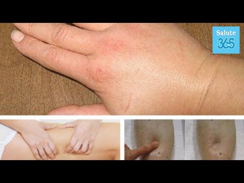 Metodi farmacologici di cura di alcolismo e tossicodipendenza Come smettere di bere e restituire la ragazza