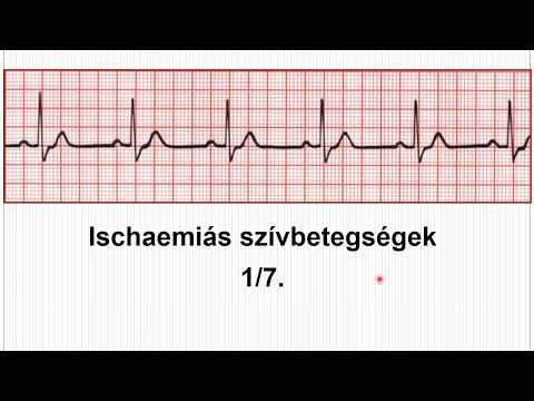 fa tetvek és magas vérnyomás zene a magas vérnyomás ellen