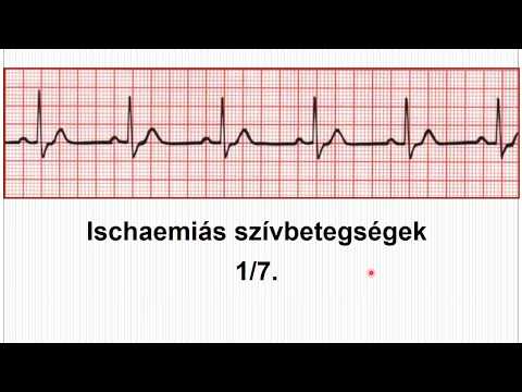 ami rosszabb mint az 1 vagy 2 fokozatú magas vérnyomás)