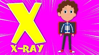Phonics letter X | phonics songs for kids | abc song | alphabet X song