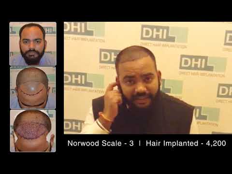 DHI Medical Group- Global Leader in Hair Transplant and Restoration | Patient onial-Must Watch