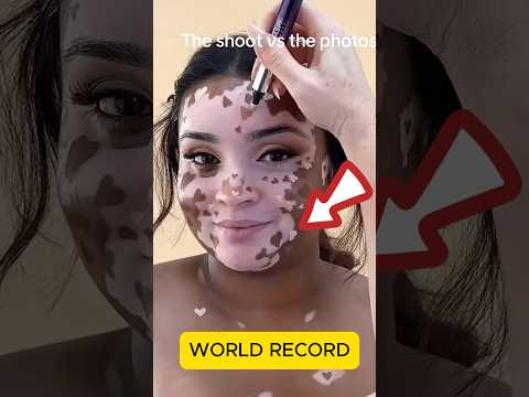 Vitiligo: An Art Project and Photoshoot That Will Change Your Perception of Beauty