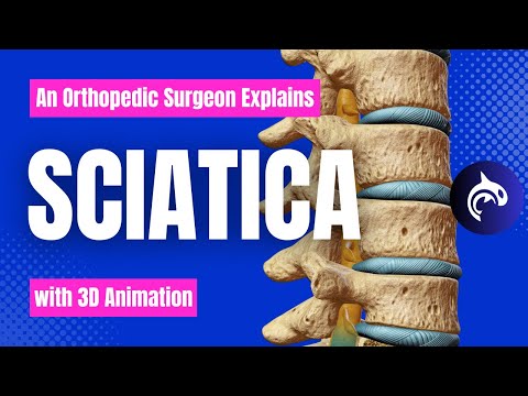 Lumbar Stenosis 3D Animation