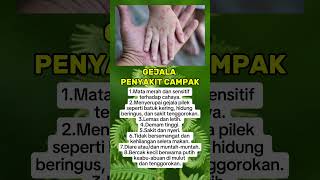 Download lagu GEJALA PENYAKIT CAMPAK, WASPADALAH #gejala  #penyakit #campak mp3 Download lagu GEJALA PENYAKIT CAMPAK, WASPADALAH #gejala  #penyakit #campak mp3